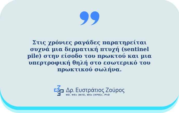 Ραγάδα δακτυλίου