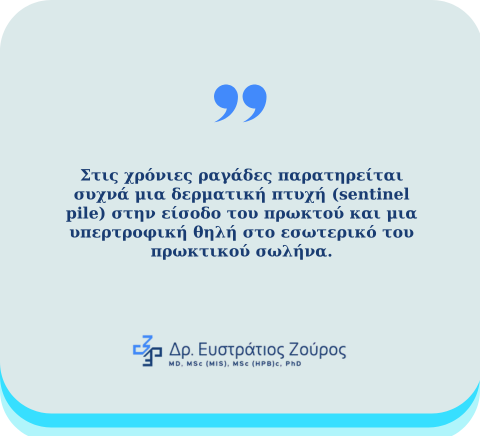 Ραγάδα δακτυλίου