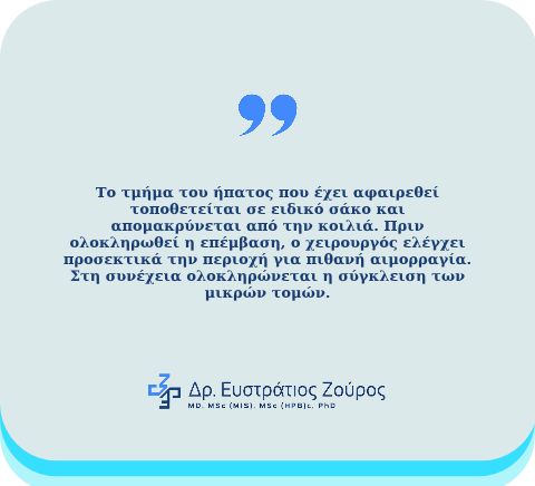 ρομποτική ηπατεκτομή